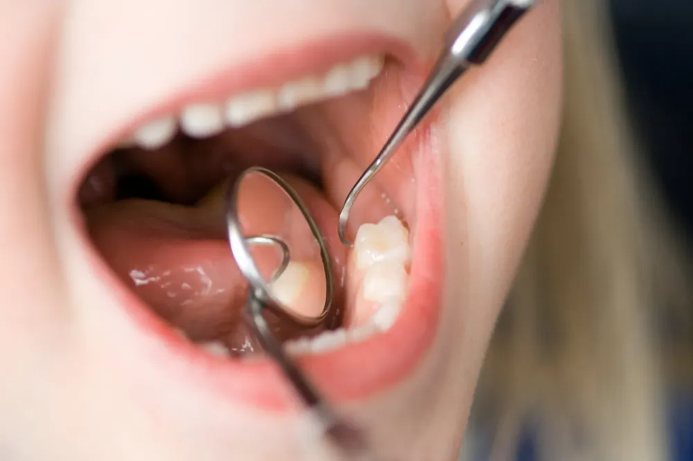 dentiste pour enfant à Genval