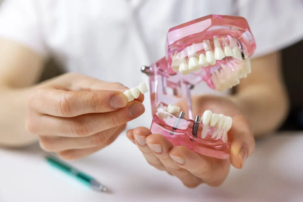 Implant dentaire